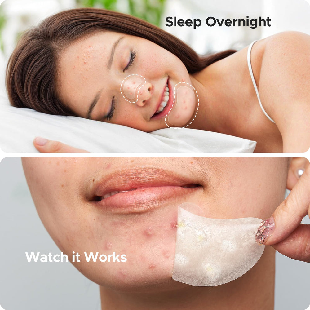 TKTK chin patch size L 38x26 mm half-moon for targeted spots.