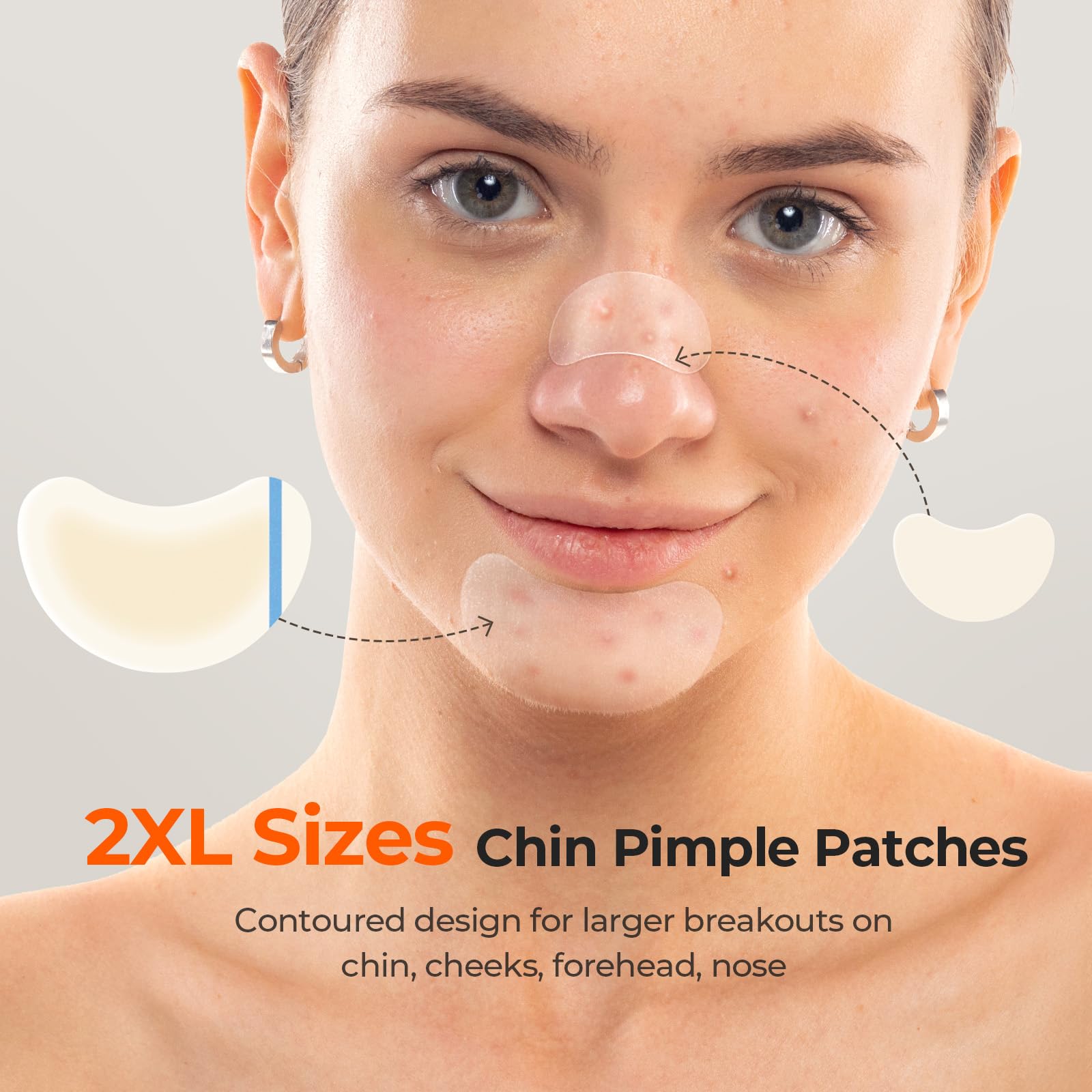 TKTK XL chin patch 62x42 mm provides full coverage for large breakouts.