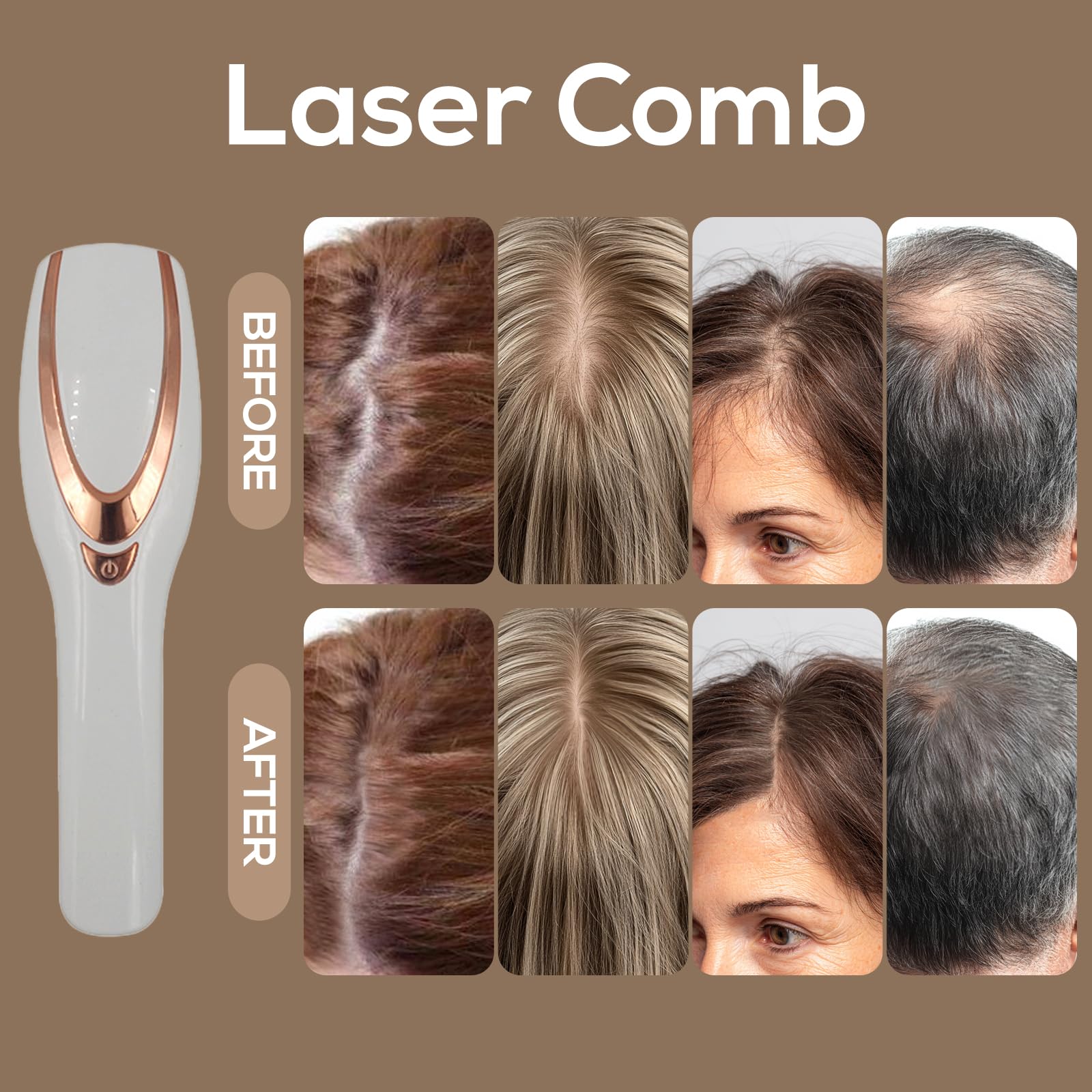 TMOSSO Laser Therapy Hair Growth Comb portable design for travel-friendly care.