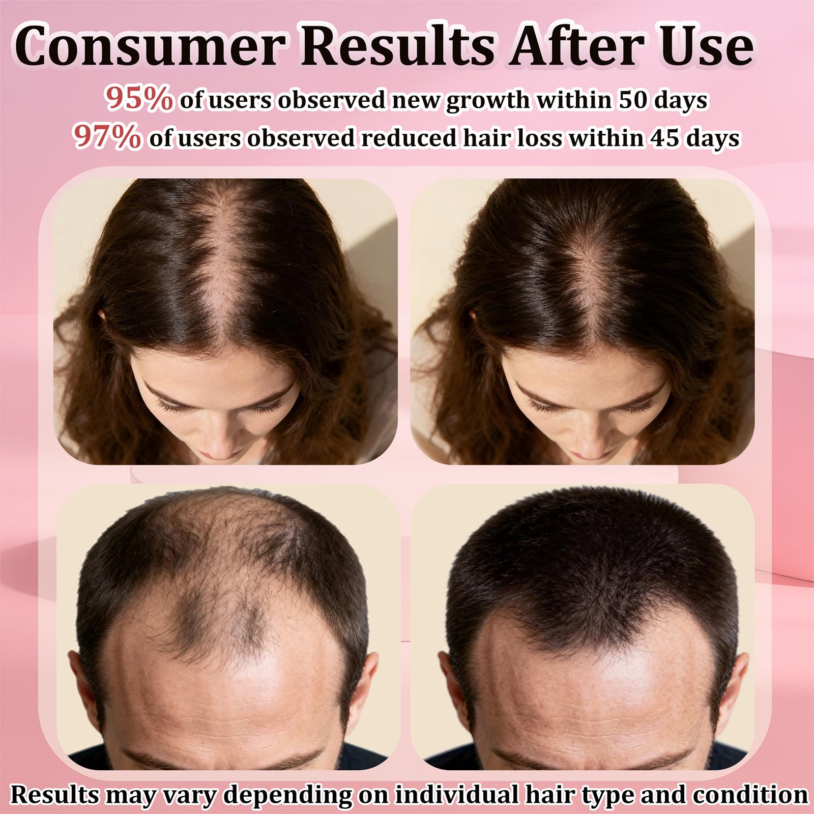 TNEGHC Minoxidil spray nozzle in action for precise scalp targeting and easy massaging.