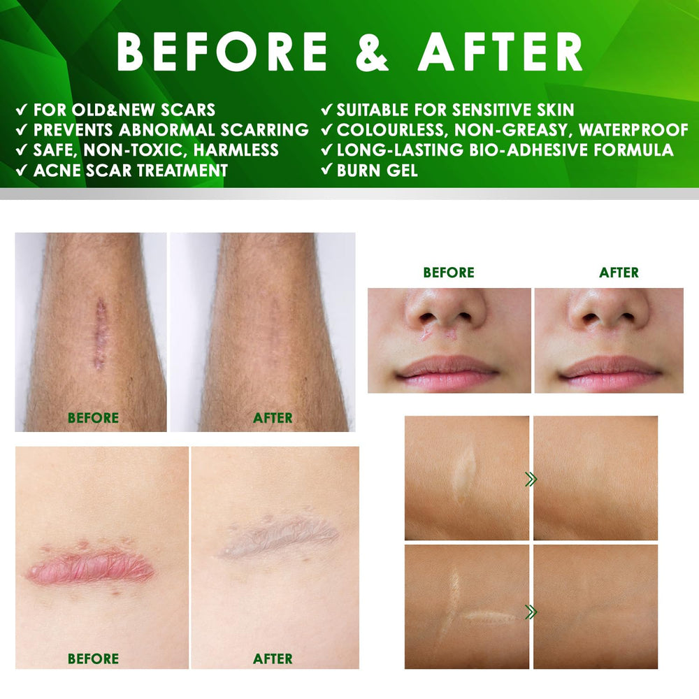 Tobcharm ear-area application demonstrates daily scar care routine