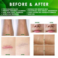 Tobcharm ear-area application demonstrates daily scar care routine