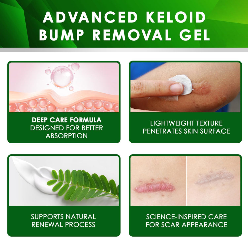 Tobcharm gel texture closeup demonstrates smooth application for scar care