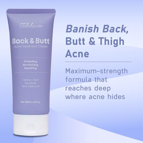 Tobcharm chest acne-clearing lotion for radiant, even-toned skin