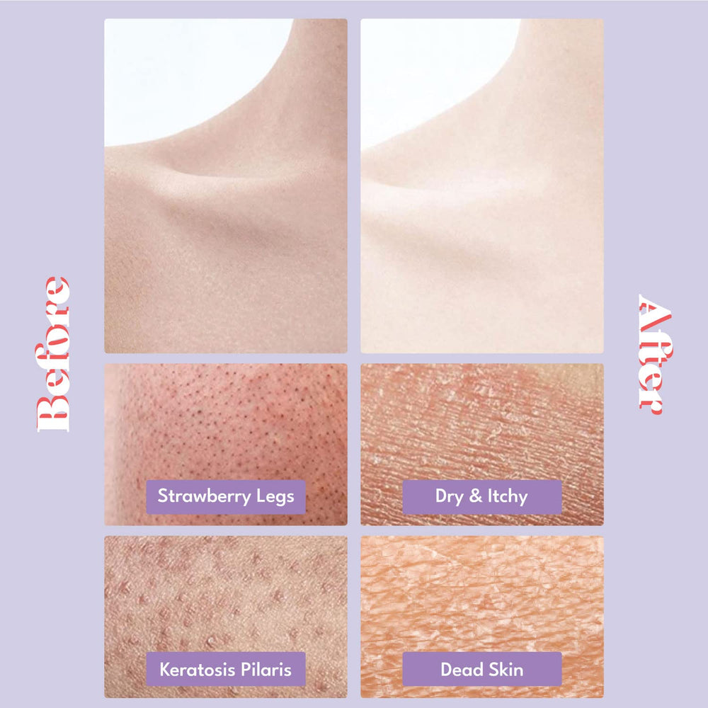 TOI:L embossed pad close-up showing textured surface for smoother skin.