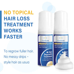 Tomum Minoxidil Foam on receding hairline for targeted support