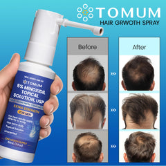Tomum Minoxidil spray 60ml bottle for easy daily use.