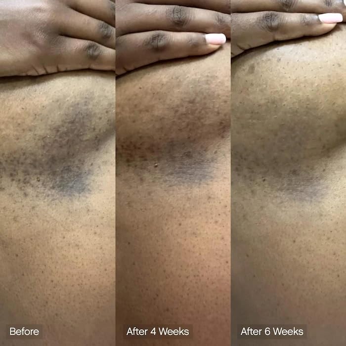 Topicals Faded cleansing bar body application supports moisturizing routine.