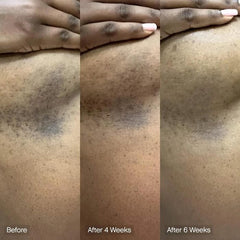 Topicals Faded cleansing bar body application supports moisturizing routine.