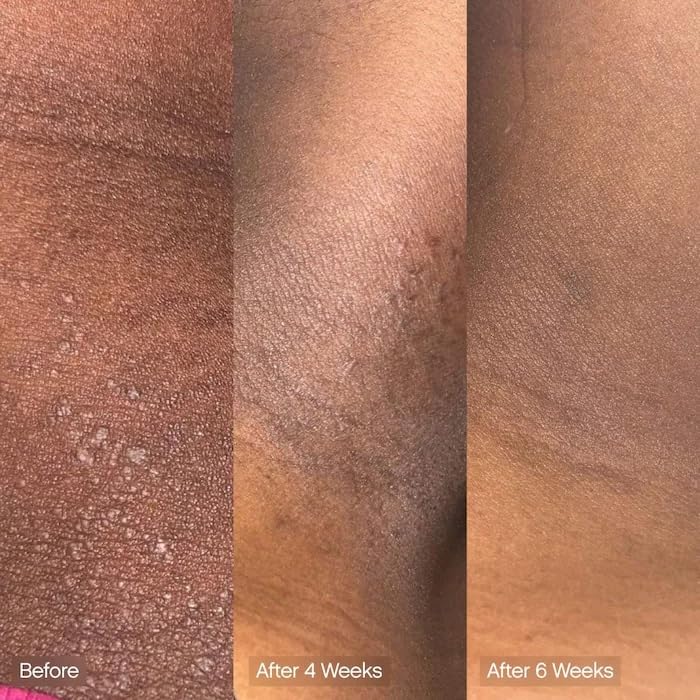 Topicals Faded cleansing bar ingredients graphic highlights kojic acid and vitamin C.