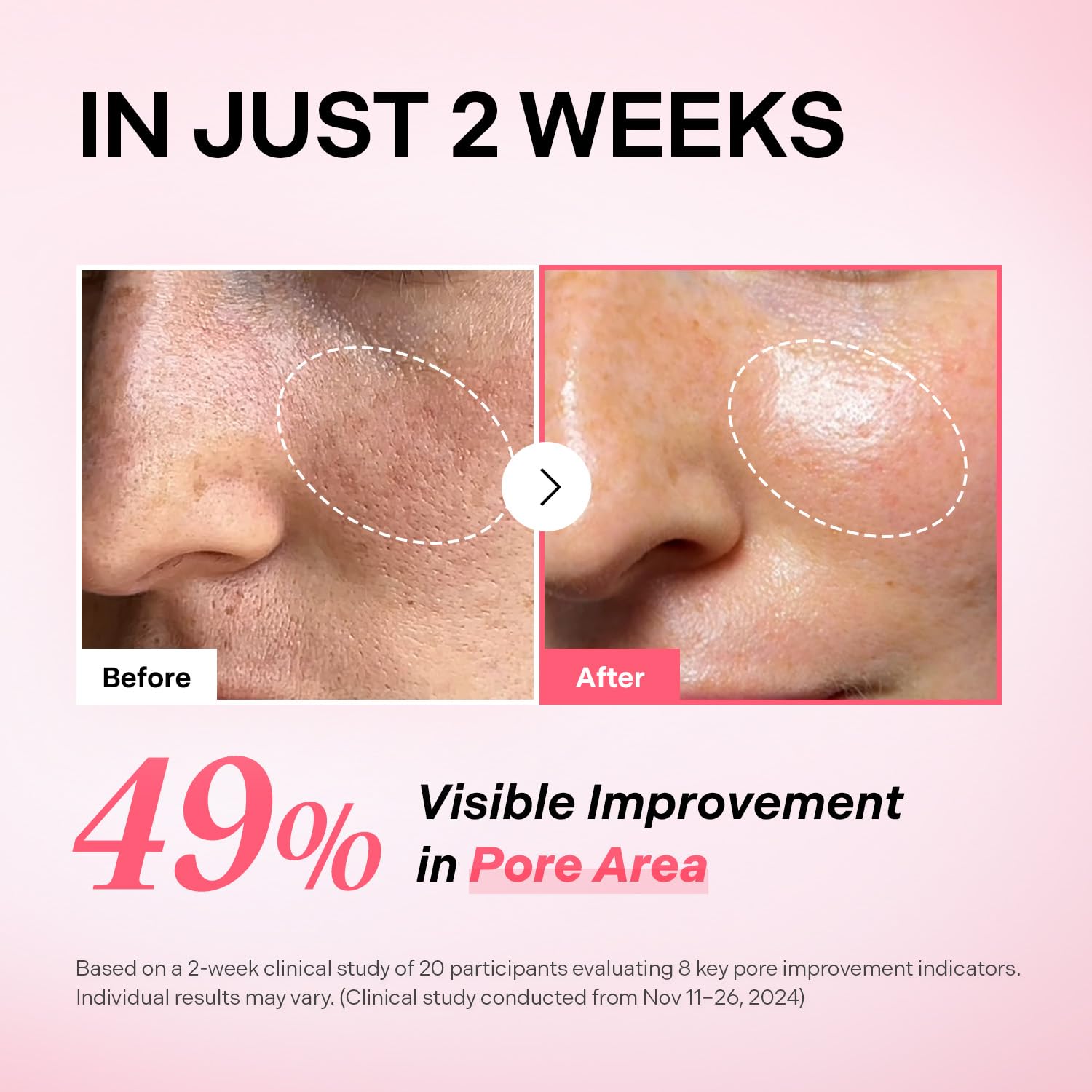 Torriden Cellmazing ampoule dropper closeup highlights rapid absorption for fresh skin.