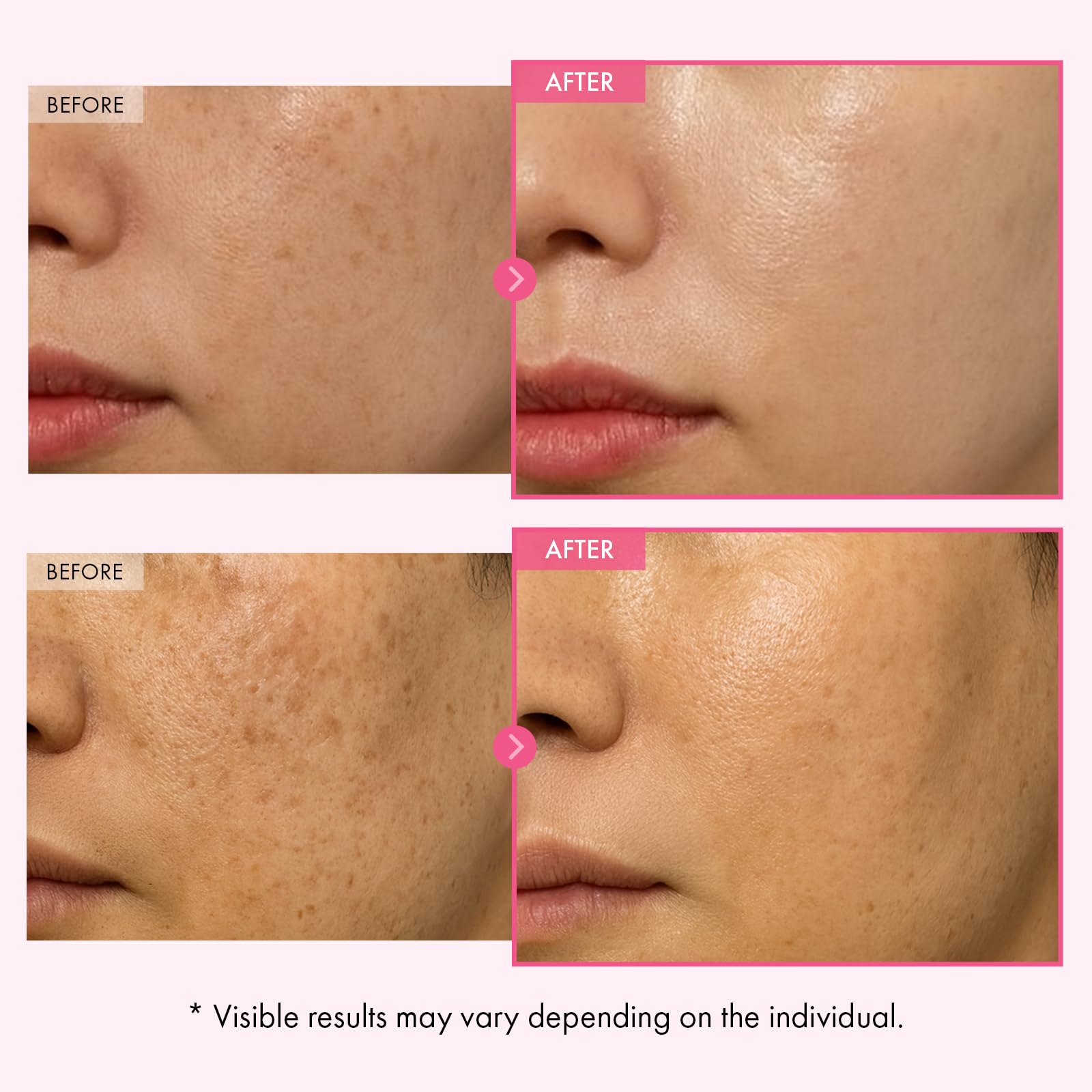 TOSOWOONG Arbutin Cream spread, quick absorption for hydrated, comfortable skin.