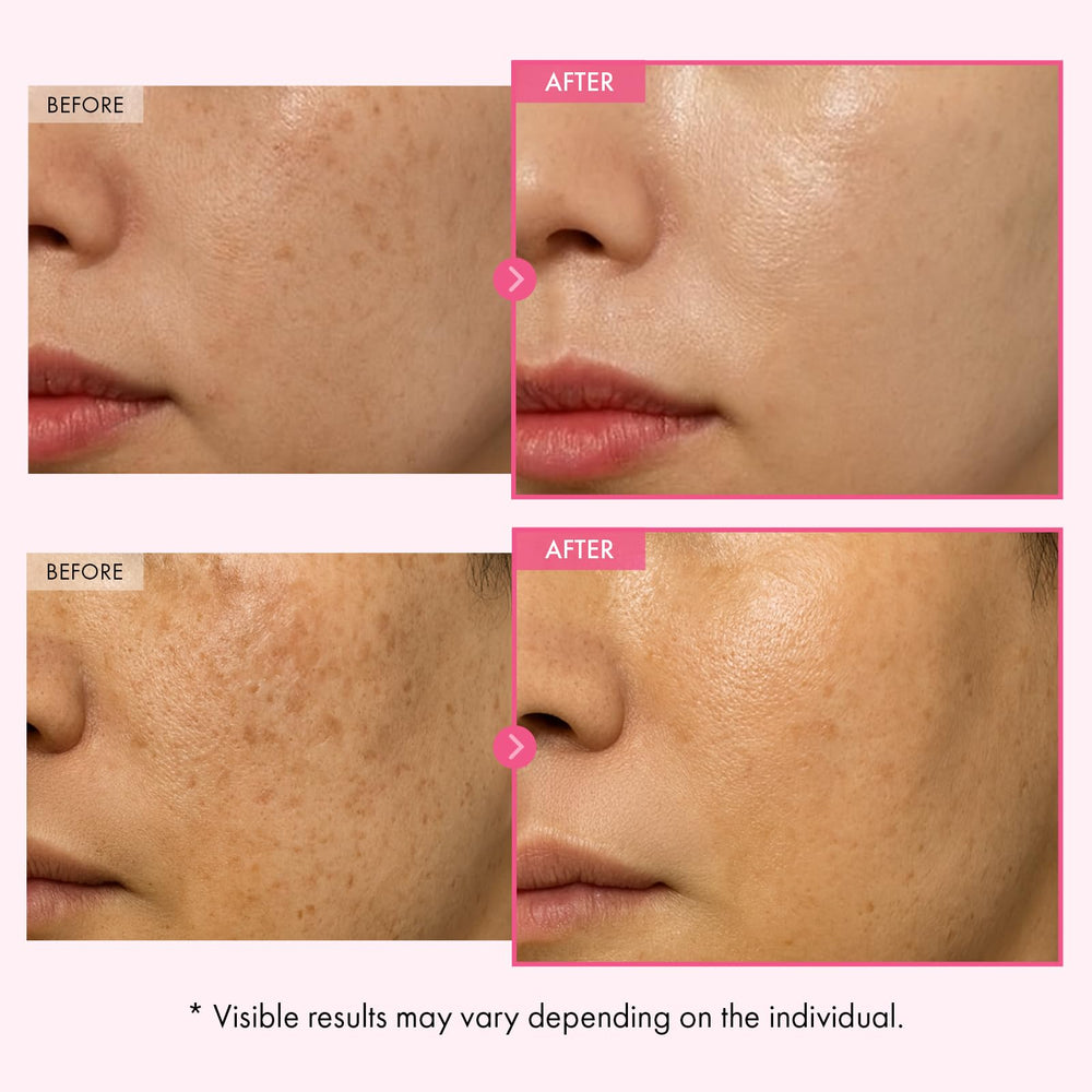 TOSOWOONG Arbutin Cream spread, quick absorption for hydrated, comfortable skin.