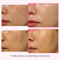 TOSOWOONG Arbutin Cream spread, quick absorption for hydrated, comfortable skin.