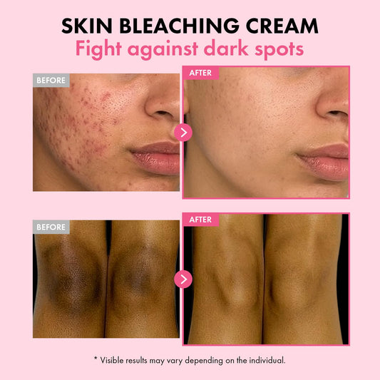 TOSOWOONG Dark Spot 35 cream packaging highlighting rich Korean actives.