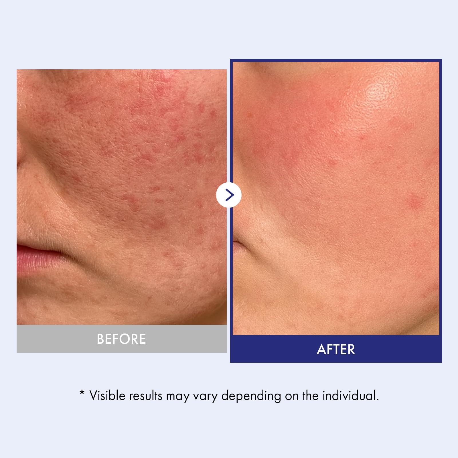 TOSOWOONG Panthenol 20 Barrier Cream ingredients highlighted for moisture retention.