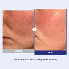 TOSOWOONG Panthenol 20 Barrier Cream ingredients highlighted for moisture retention.