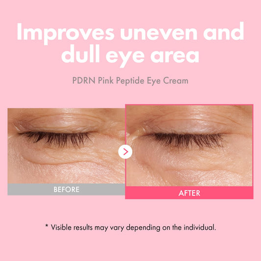 TOSOWOONG PDRN Pink Peptide Eye Cream jar closeup highlighting rich texture for smooth application
