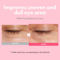 TOSOWOONG PDRN Pink Peptide Eye Cream jar closeup highlighting rich texture for smooth application