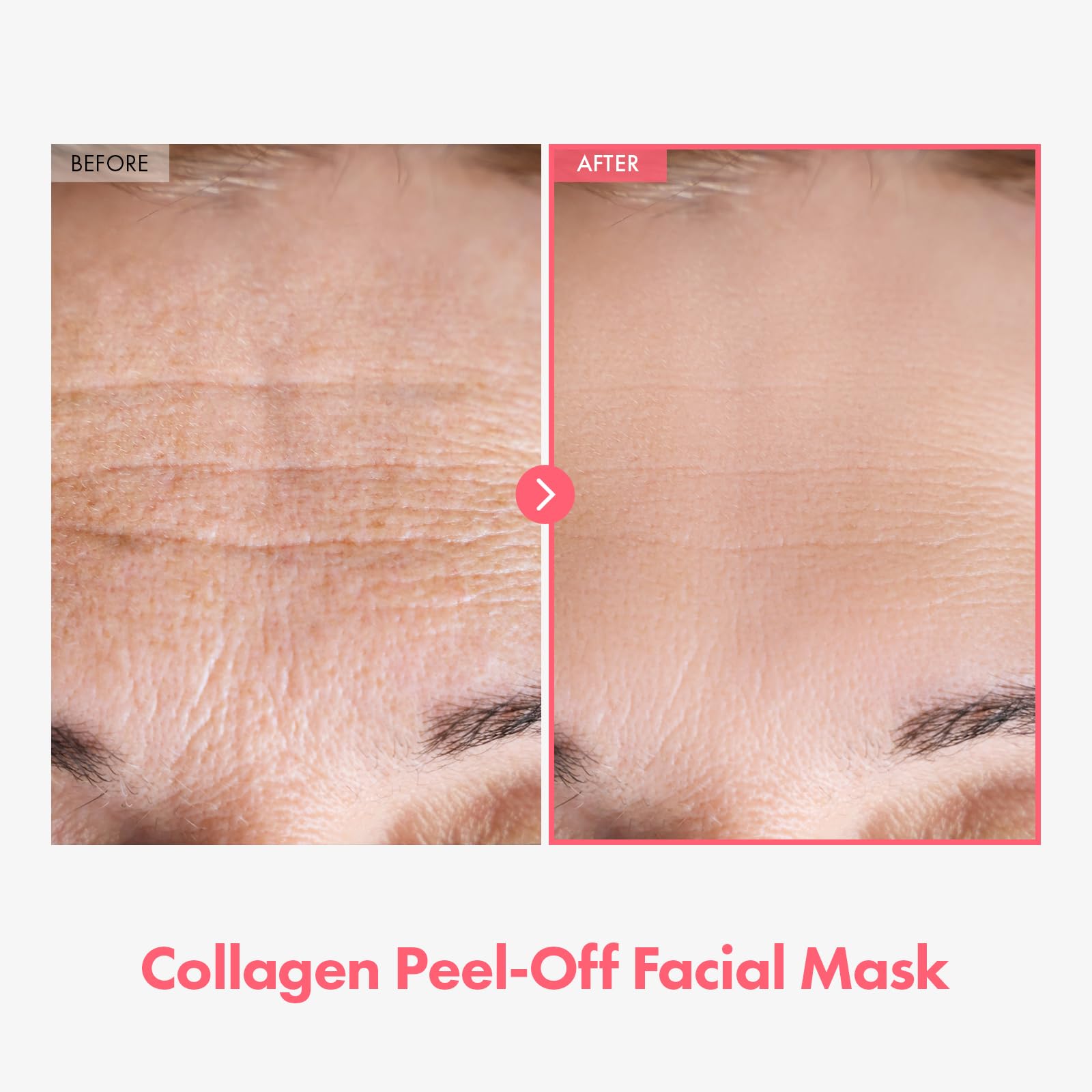 TOSOWOONG Real Collagen hydration glow after mask shows radiant skin.