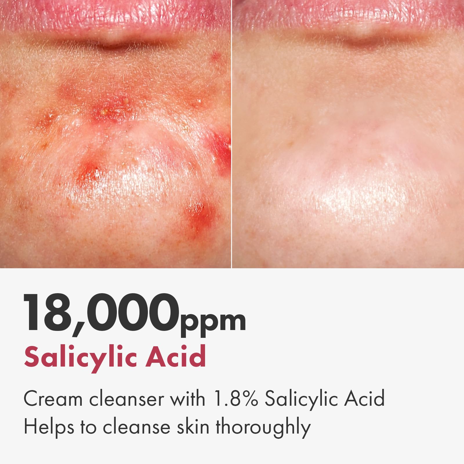 TOSOWOONG Salicylic Acid Foam Cleanser pump-dispense enables easy daily use