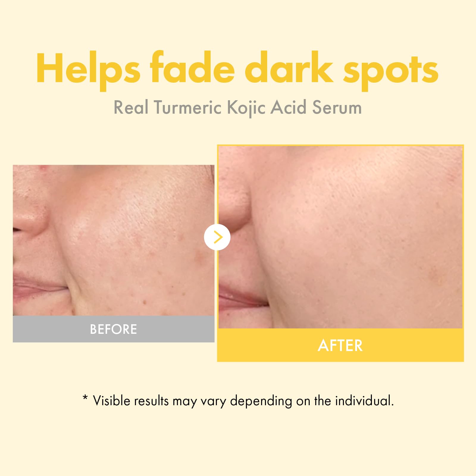 Tosowoong serum texture closeup shows lightweight formula for daily use