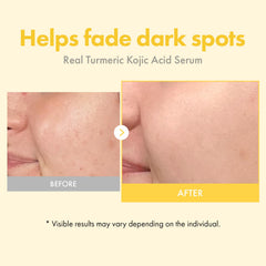 Tosowoong serum texture closeup shows lightweight formula for daily use