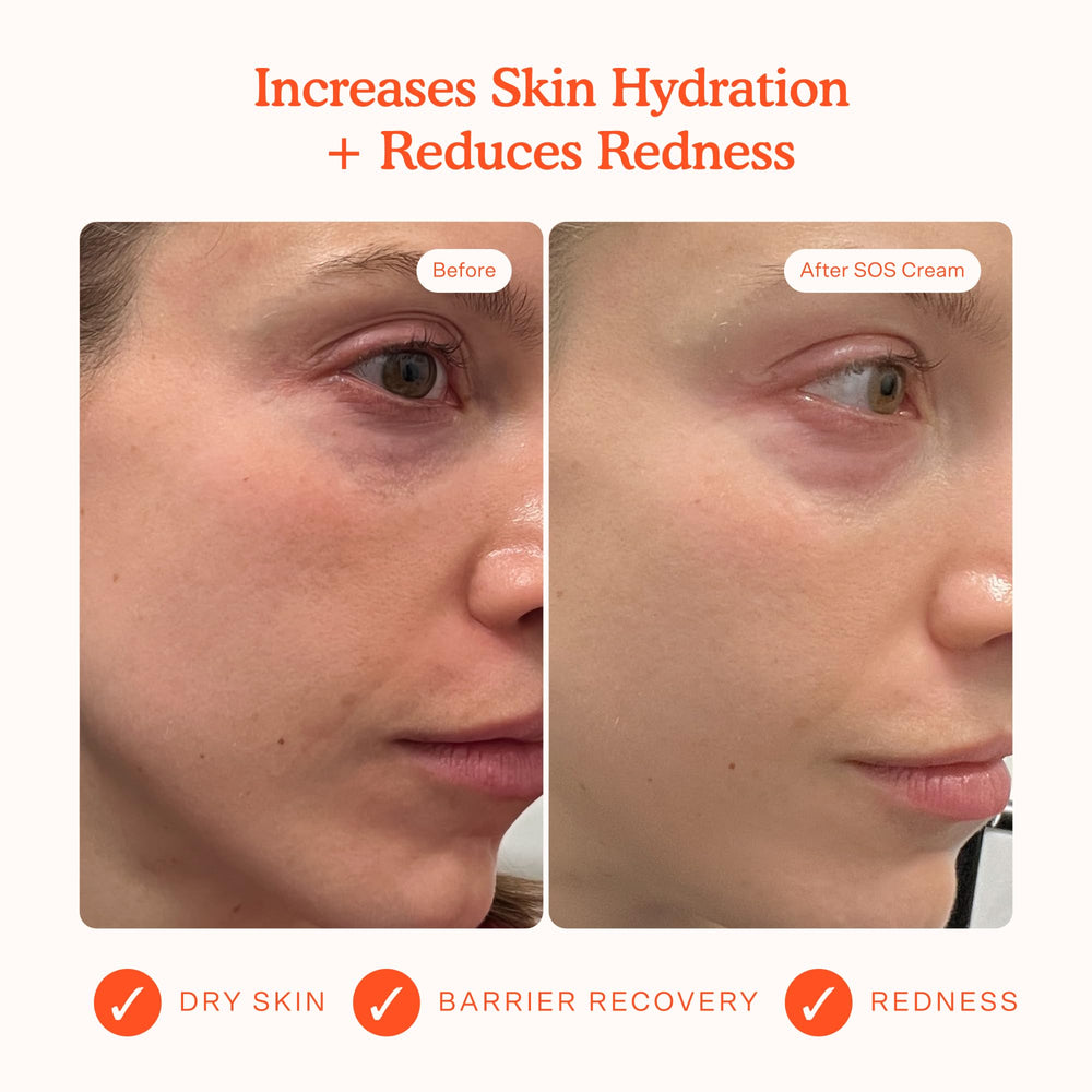 Tower 28 SOS Recovery Face Cream swatch on skin highlighting deep hydration