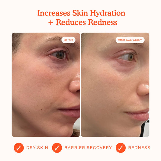 Tower 28 SOS Recovery Face Cream swatch on skin highlighting deep hydration