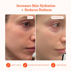 Tower 28 SOS Recovery Face Cream swatch on skin highlighting deep hydration