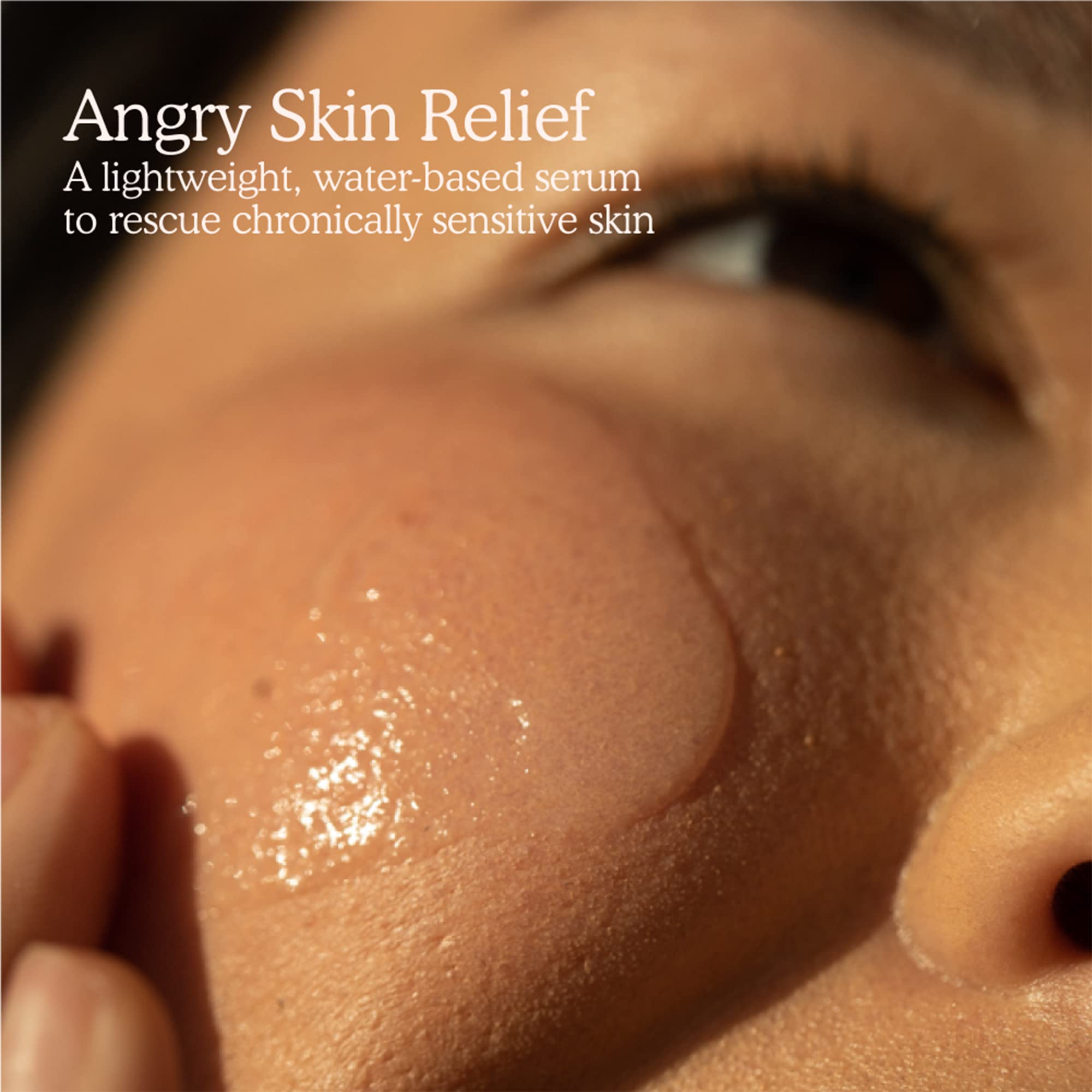 Tower 28 SOS Rescue Serum applied on hand demonstrates gentle, quick-absorb hydration.