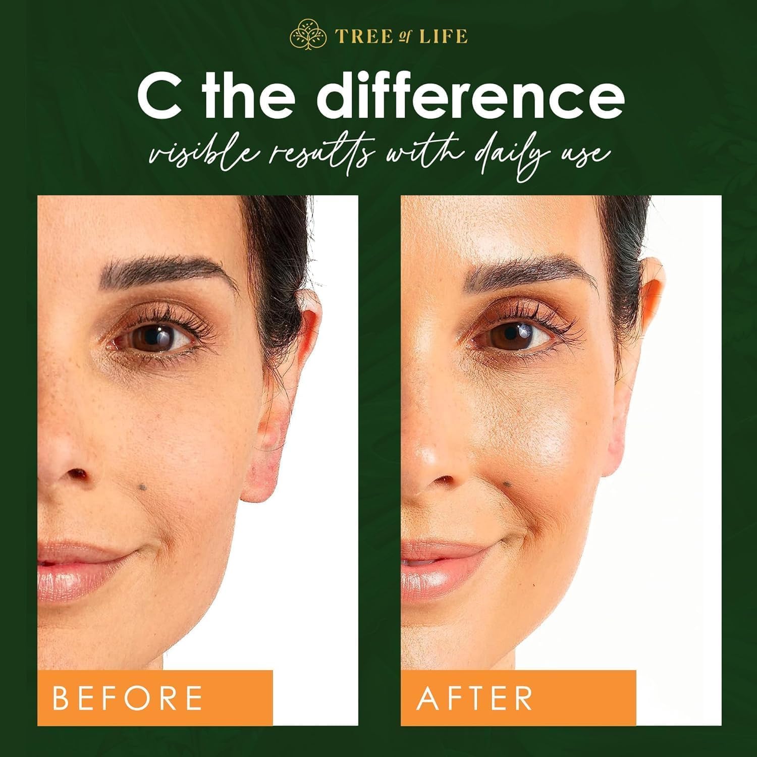 Tree of Life Beauty vitamin C vitamin E ingredient glow enhancement for sensitive skin