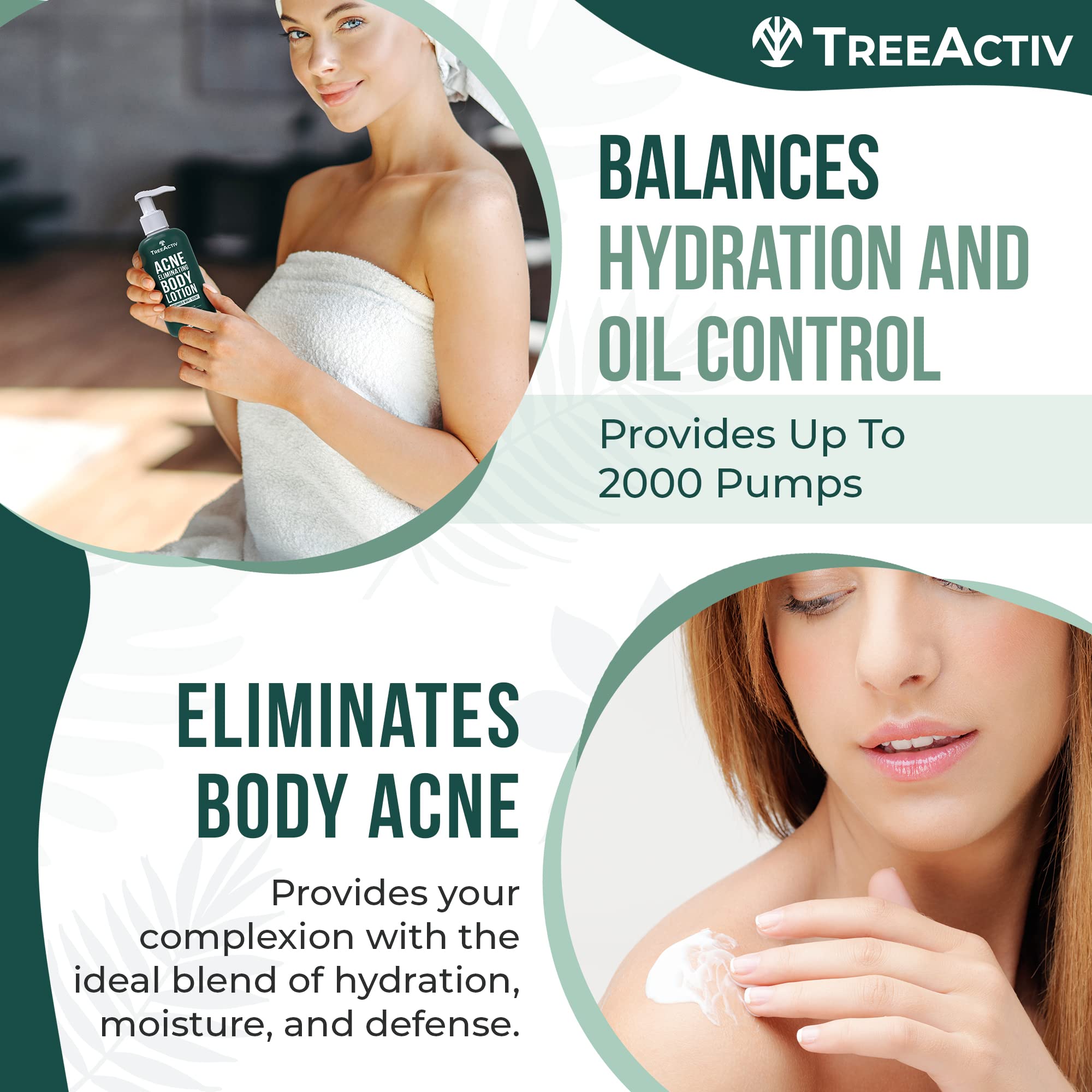 TreeActiv Acne Eliminating Body Lotion on back area during application for acne-prone skin care.