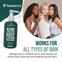 TreeActiv Acne Eliminating Body Lotion pump dispenses a lightweight, fast-absorbing formula.