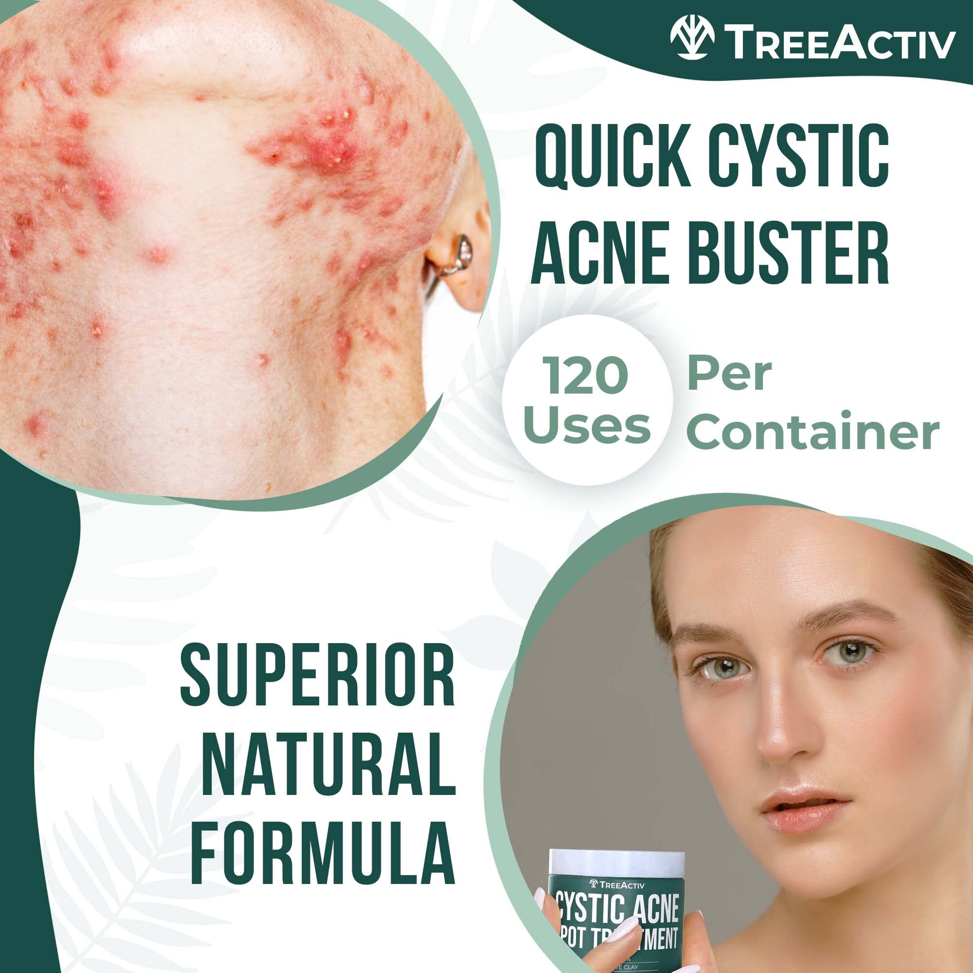 TreeActiv aloe soothing detail on skin demonstrates gentle support for sensitive skin.