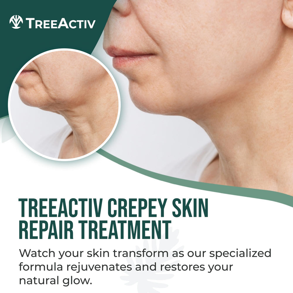 TreeActiv Cream texture close-up reveals rich, hydrating formula for crepey skin