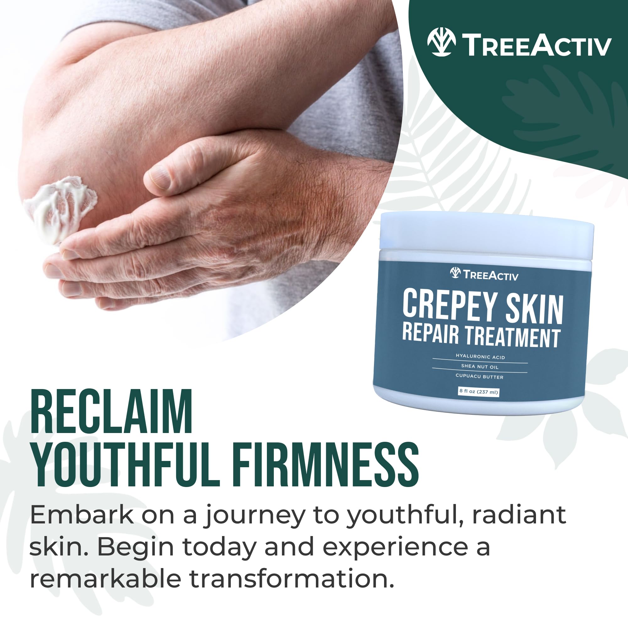 TreeActiv Crepey Skin Repair Cream 8 oz tub ready for daily routines