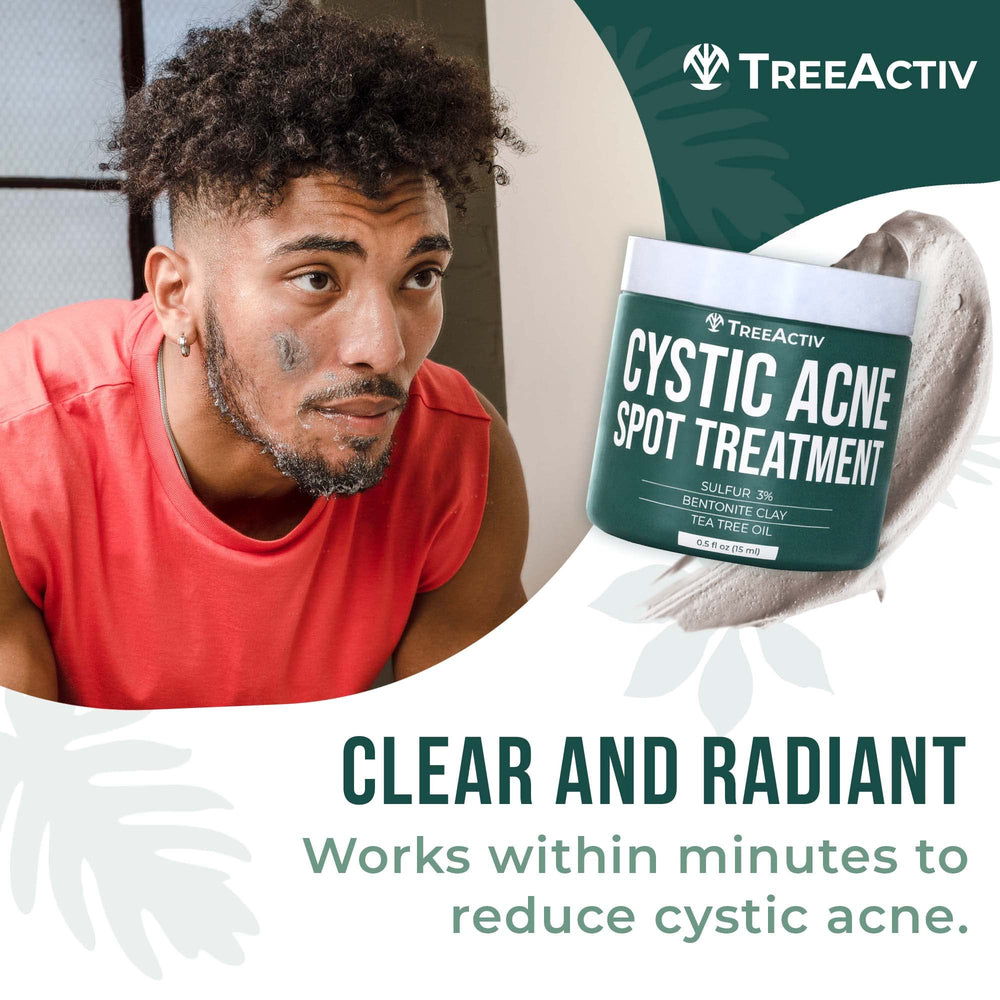 TreeActiv cystic acne spot treatment packaging close-up for face and body use.