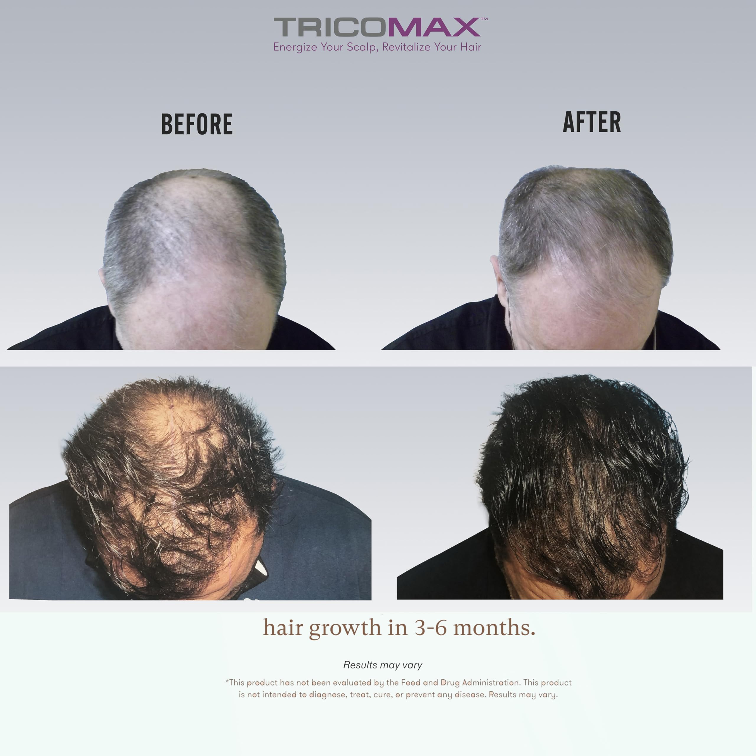 Tricomax product on a bathroom vanity for everyday hair care.