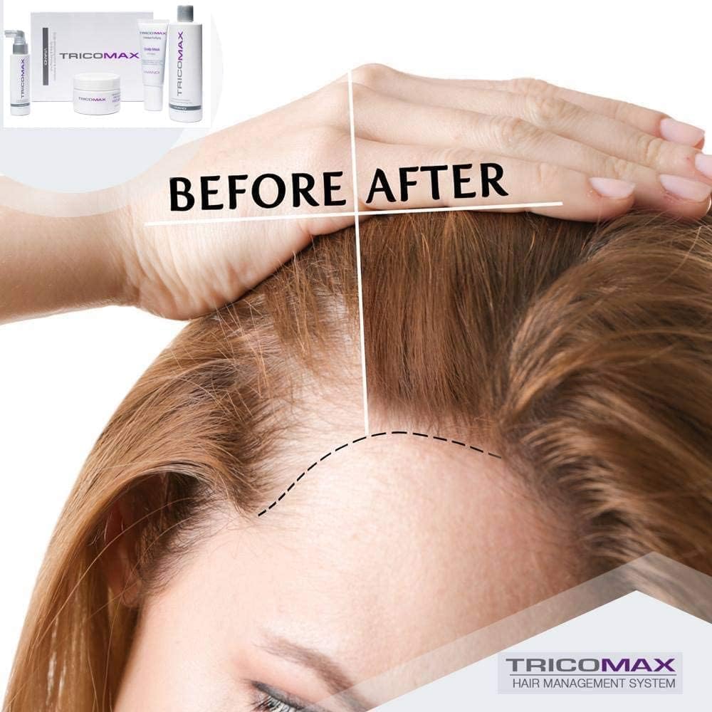 Tricomax bottle suggests nails and skin nourishment alongside hair benefits.