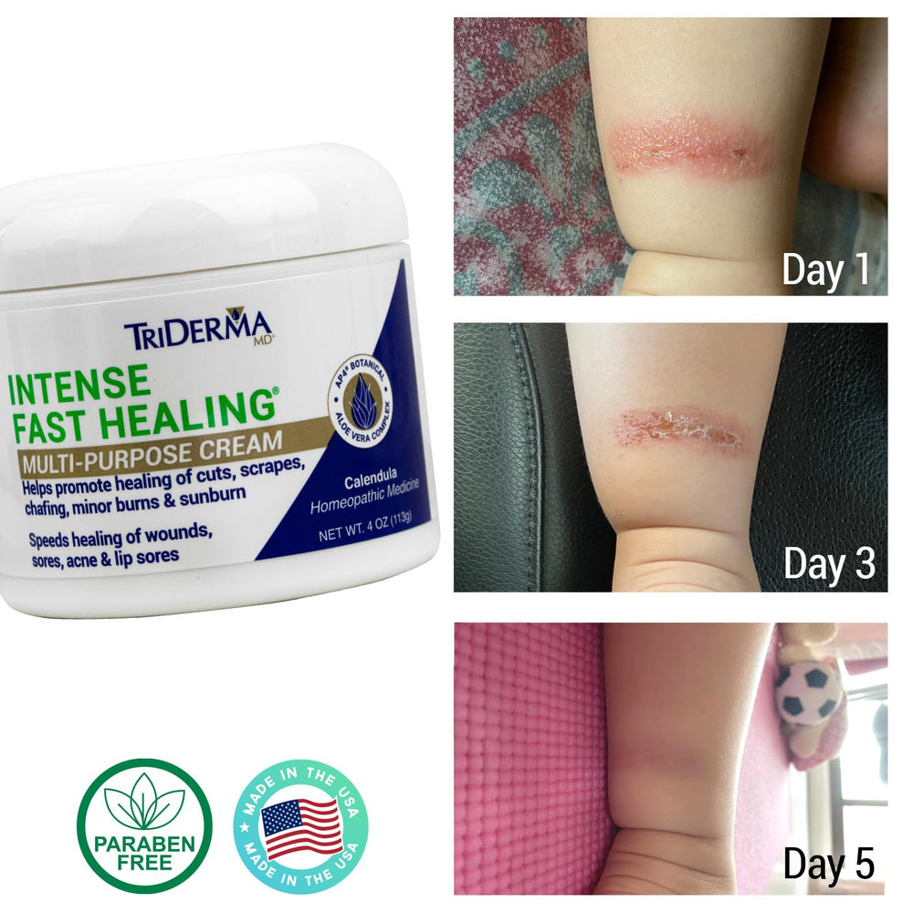 TriDerma AP4 Aloe Vera Complex jar soothing irritated skin