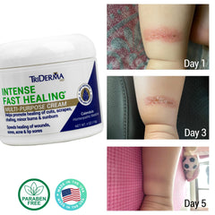 TriDerma AP4 Aloe Vera Complex jar soothing irritated skin
