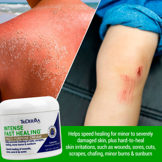 TriDerma Intense Fast Healing Cream application demonstrates easy soothing massage