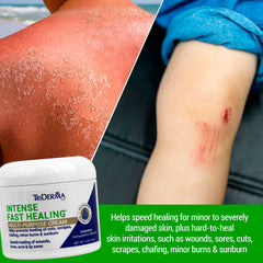TriDerma Intense Fast Healing Cream application demonstrates easy soothing massage