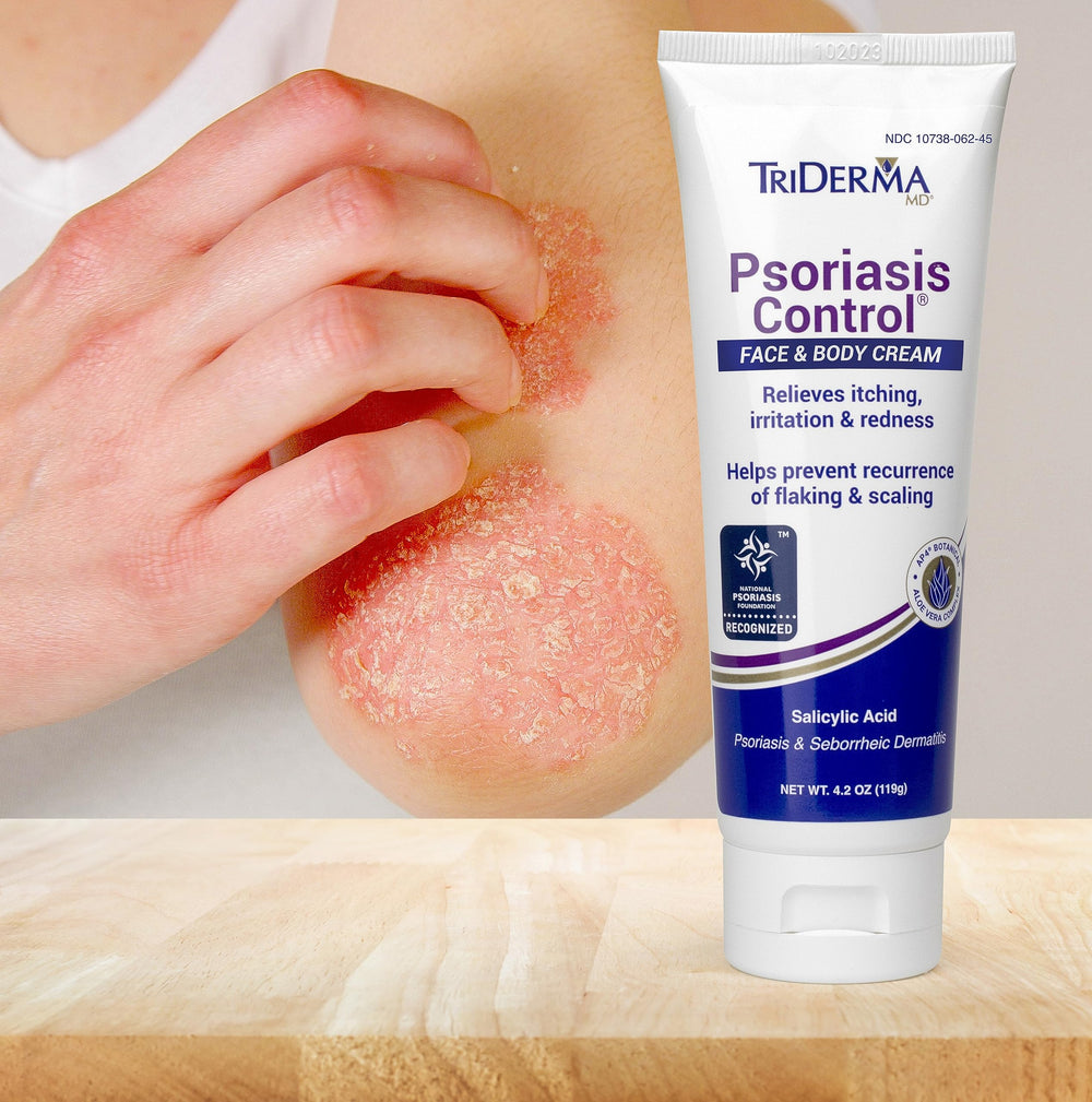 TriDerma Psoriasis Control Cream after-application glow suggests immediate comfort.