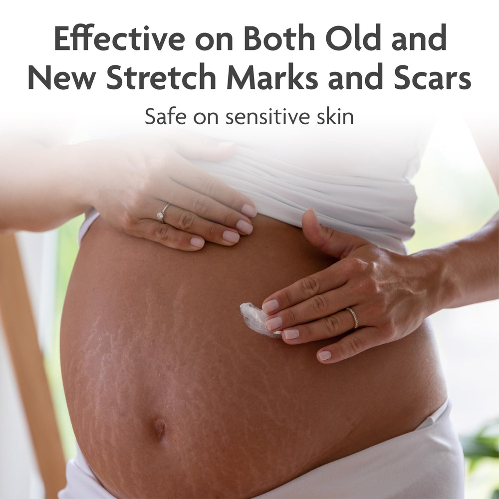 TriLASTIN Stretch Mark Cream being applied to hips and thighs for target care.