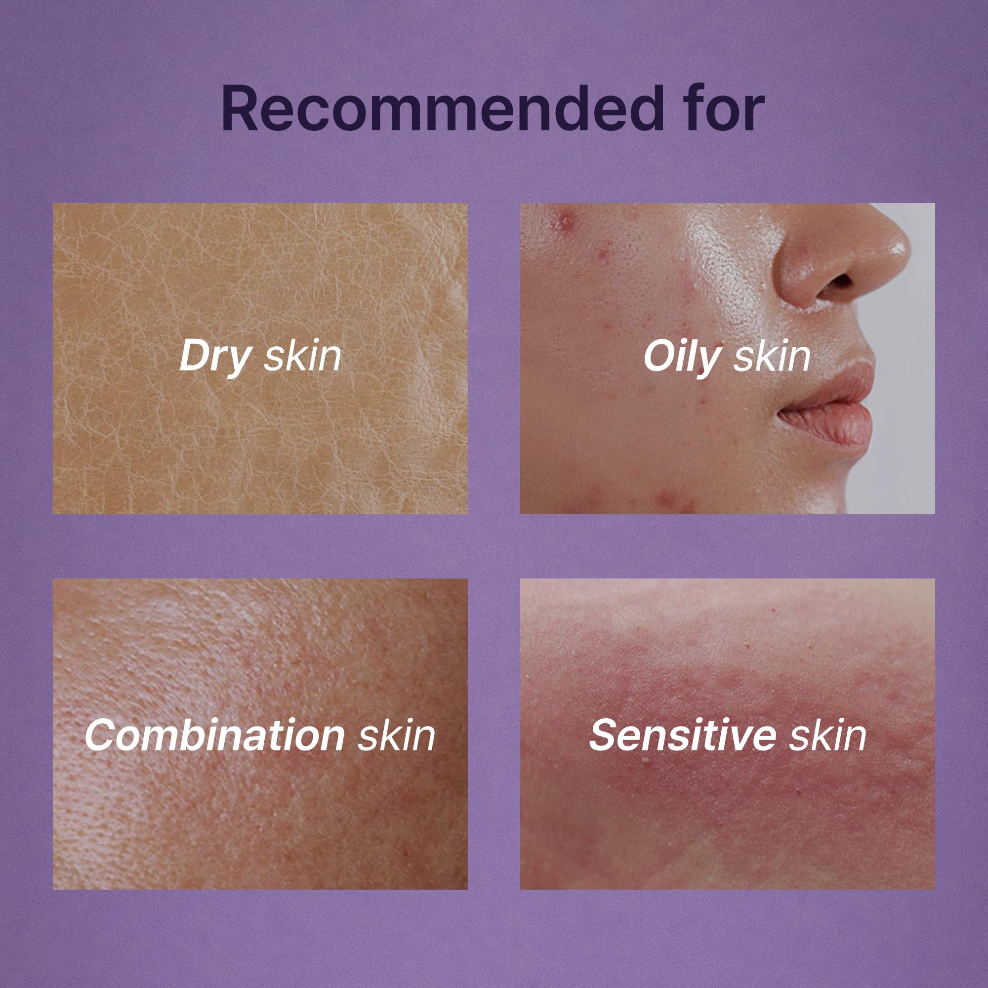 Troiareuke ACSEN cleanser is hypoallergenic and noncomedogenic for sensitive skin.