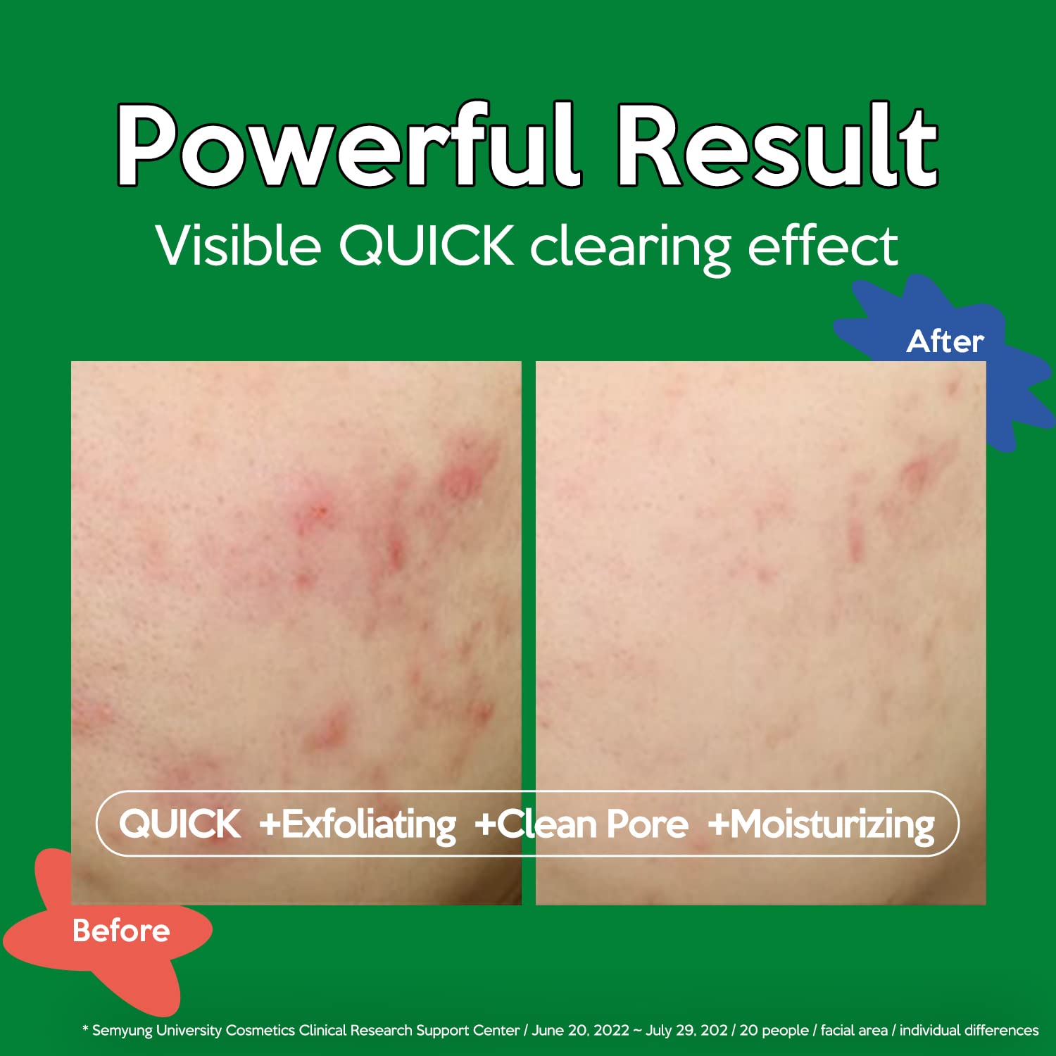Troubless Clear Toner Pad daily-use convenience for quick cleansing
