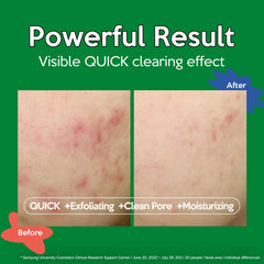 Troubless Clear Toner Pad daily-use convenience for quick cleansing
