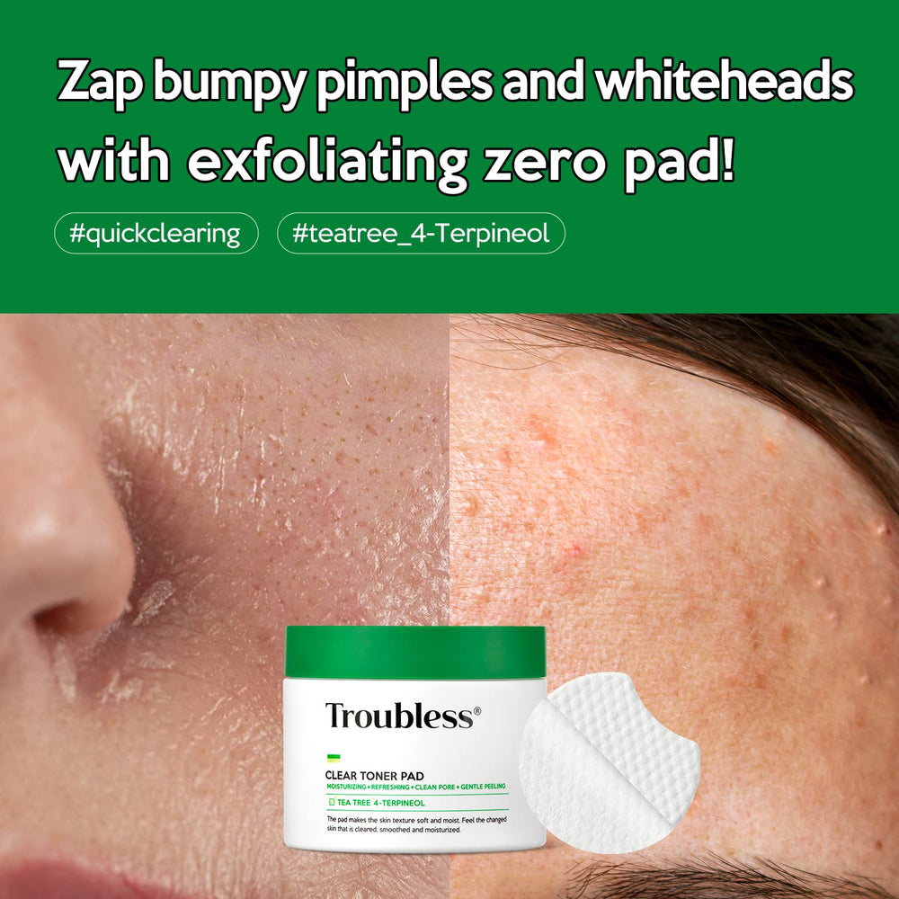 Troubless Clear Toner Pad tea tree formula supports oil-control